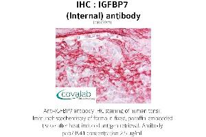 Image no. 2 for anti-Insulin-Like Growth Factor Binding Protein 7 (IGFBP7) (Internal Region) antibody (ABIN1735789) (IGFBP7 anticorps  (Internal Region))