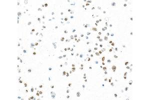Immunocytochemistry (ICC) image for anti-Forkhead Box Q1 (FOXQ1) (AA 353-403) antibody (ABIN7455177) (Recombinant FOXQ1 anticorps  (AA 353-403))