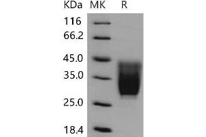 Western Blotting (WB) image for CD99 Molecule-Like 2 (CD99L2) (Active) protein (His tag) (ABIN7320248)