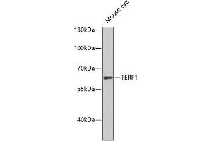 Western blot analysis of extracts of mouse eye, using TERF1 antibody (ABIN1683138, ABIN3015078, ABIN3015079 and ABIN6213631) at 1:1000 dilution. (TRF1 anticorps  (AA 240-419))