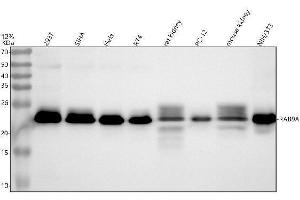 Western blot analysis of RAB9A using anti-RAB9A antibody (ABIN7606116).