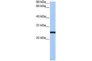 WB Suggested Anti-CCDC46 Antibody Titration: 0. (CCDC46 anticorps  (C-Term))