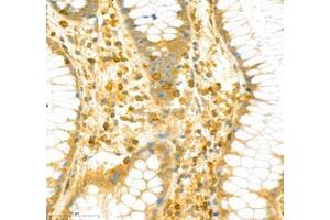 Immunohistochemistry of paraffin embedded human colon using PTPN12 (ABIN7075292) at dilution of 1: 2500 (400x lens)