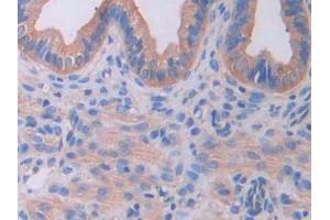 IHC-P analysis of Mouse Uterus Tissue, with DAB staining. (IL18RAP anticorps  (AA 396-548))