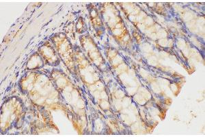 Immunohistochemistry of paraffin-embedded Mouse colon using HRAS Polycloanl Antibody at dilution of 1:200 (HRAS anticorps)