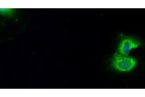 Image no. 7 for anti-B-Raf proto-oncogene, serine/threonine kinase (BRAF) antibody (ABIN1496954) (BRAF anticorps)