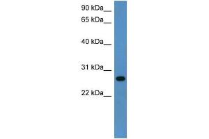 Rat Lung; WB Suggested Anti-Cyb5r2 Antibody Titration: 0. (CYB5R2 anticorps  (C-Term))