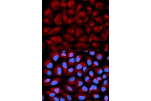 Immunofluorescence analysis of U2OS cell using FANCC antibody. (FANCC anticorps  (AA 319-558))