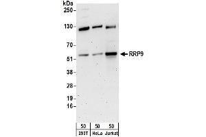Western Blotting (WB) image for anti-Ribosomal RNA Processing 9, Small Subunit (SSU) Processome Component, Homolog (RRP9) (AA 175-225) antibody (ABIN7449812)