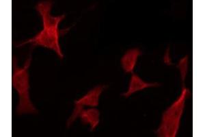 ABIN6278595 staining HepG2 by IF/ICC.