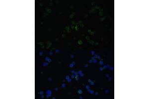 Immunofluorescence analysis of Jurkat cells using CD3D antibody (ABIN3021813, ABIN3021814, ABIN3021815 and ABIN6215992) at dilution of 1:100. (CD3D anticorps  (AA 22-105))