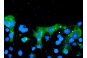 Anti-C20orf30 mouse monoclonal antibody (ABIN2455884) immunofluorescent staining of COS7 cells transiently transfected by pCMV6-ENTRY C20orf30 (RC201878). (C20orf30 anticorps)