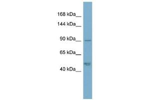 Plakophilin 2 antibody used at 1 ug/ml to detect target protein. (Plakophilin 2 anticorps  (N-Term))