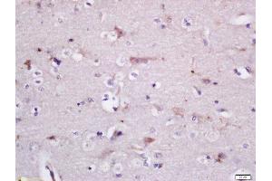 Formalin-fixed and paraffin embedded rat brain labeled with Rabbit Anti-GADD34 Polyclonal Antibody, Unconjugated (ABIN2174278) at 1:200 followed by conjugation to the secondary antibody and DAB staining (GADD34 anticorps  (AA 401-500))
