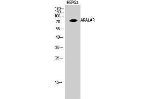 Western Blotting (WB) image for anti-Solute Carrier Family 25 (Mitochondrial Carrier, Aralar), Member 12 (Slc25a12) (Internal Region) antibody (ABIN3183346)
