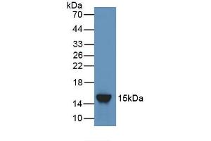 Detection of Recombinant ANGPT2, Rat using Polyclonal Antibody to Angiopoietin 2 (ANGPT2)