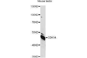 Western blot analysis of extracts of mouse testis, using CDK14 antibody (ABIN6292456) at 1:1000 dilution. (CDK14 anticorps)