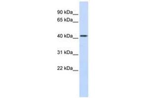 Image no. 1 for anti-Carboxypeptidase B2 (Plasma) (CPB2) (AA 324-373) antibody (ABIN6740831) (CPB2 anticorps  (AA 324-373))