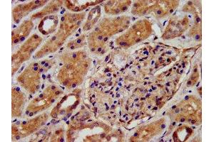 IHC image of ABIN7145029 diluted at 1:500 and staining in paraffin-embedded human kidney tissue performed on a Leica BondTM system. (KCNJ8 anticorps  (AA 299-424))