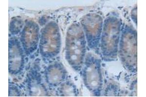 IHC-P analysis of Rat Intestine Tissue, with DAB staining. (CEACAM1 anticorps  (AA 36-145))