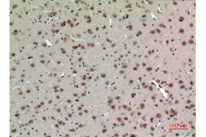 Immunohistochemistry (IHC) analysis of paraffin-embedded Rat Brain, antibody was diluted at 1:100.