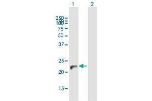 Western Blot analysis of NUDT4 expression in transfected 293T cell line by NUDT4 MaxPab polyclonal antibody.