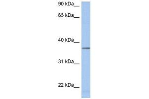 LDHAL6B antibody used at 1 ug/ml to detect target protein. (LDHAL6B anticorps  (Middle Region))