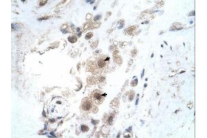 KIAA0494 antibody was used for immunohistochemistry at a concentration of 4-8 ug/ml.