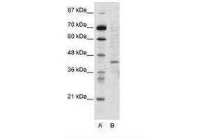 Image no. 1 for anti-Ring Finger Protein 1 (RING1) (N-Term) antibody (ABIN202445) (RING1 anticorps  (N-Term))