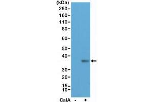 Western blot testing of lysate from human HeLa cells, untreated (-) or treated (+) with Calyculin A (CalA), with recombinant phospho-EIF2A antibody at 1:200 dilution. (Recombinant EIF2A anticorps  (pSer51))