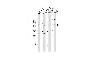All lanes : Anti-RGS3 Antibody (N-Term) at 1:1000 dilution Lane 1: MCF-7 whole cell lysate Lane 2: U-87 MG whole cell lysate Lane 3: D whole cell lysate Lane 4: Hela whole cell lysate Lysates/proteins at 20 μg per lane. (RGS3 anticorps  (AA 273-307))
