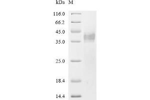 (Tris-Glycine gel) Discontinuous SDS-PAGE (reduced) with 5 % enrichment gel and 15 % separation gel.