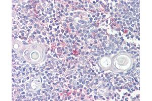 Anti-LITAF antibody IHC of human thymus. (LITAF anticorps  (AA 51-64))