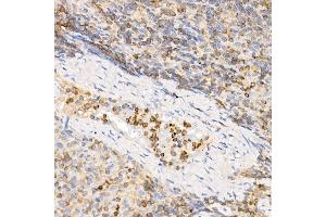 Immunohistochemistry of paraffin-embedded rat spleen using IL21 Rabbit pAb (ABIN6128086, ABIN6142359, ABIN6142360 and ABIN6223071) at dilution of 1:50 (40x lens). (IL-21 anticorps  (AA 25-162))
