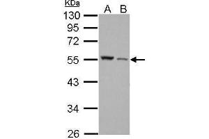 WB Image Desmin antibody detects DES protein by Western blot analysis.