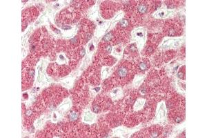 Formalin-fixed and paraffin-embedded H.