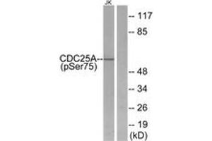 Western blot analysis of extracts from Jurkat cells treated with UV, using CDC25A (Phospho-Ser75) Antibody.