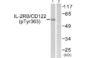 Western blot analysis of extracts from COS7 cells, using IL-2Rβ/CD122 (Phospho-Tyr364) antibody. (IL2 Receptor beta anticorps  (pTyr364))
