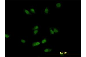 Immunofluorescence of monoclonal antibody to CSE1L on HeLa cell. (Exportin 2 anticorps  (AA 872-971))