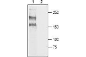 Western blot analysis of rat DRG lysate: - 1. (Nav1.8 anticorps  (C-Term, Intracellular))