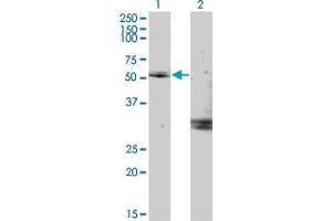 Western Blot analysis of MYOC expression in transfected 293T cell line by MYOC monoclonal antibody (M02), clone 2B4. (MYOC anticorps  (AA 1-504))