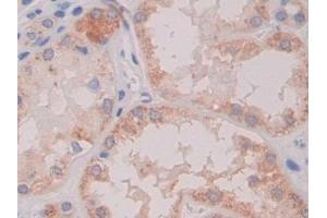 Detection of CTXI in Human Kidney Tissue using Monoclonal Antibody to Cross Linked C-Telopeptide Of Type I Collagen (CTXI)