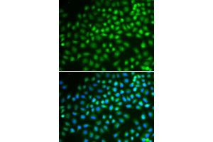 Immunofluorescence analysis of HeLa cells using SMARCA5 antibody.