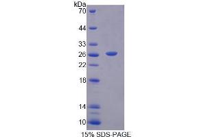 SDS-PAGE analysis of Human TRO Protein. (TRO Protéine)