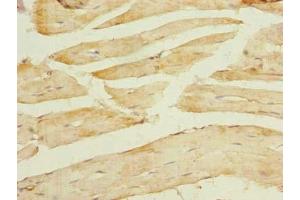 Immunohistochemistry of paraffin-embedded human skeletal muscle tissue using ABIN7172431 at dilution of 1:100
