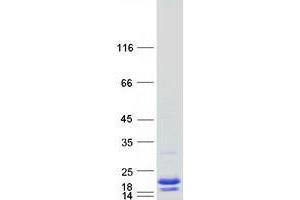 Validation with Western Blot