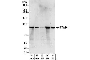 Western Blotting (WB) image for anti-Signal Transducer and Activator of Transcription 6, Interleukin-4 Induced (STAT6) (AA 600-650) antibody (ABIN7454626)