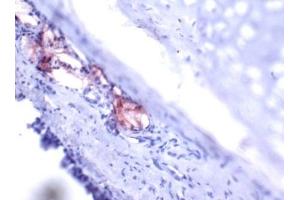 Immunohistochemistry (IHC) image for anti-Trefoil Factor 1 (TFF1) (AA 57-84), (C-Term) antibody (ABIN781662) (TFF1 anticorps  (C-Term))