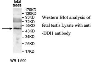 Image no. 1 for anti-DNA-Damage Inducible 1 Homolog 1 (DDI1) antibody (ABIN1576032)