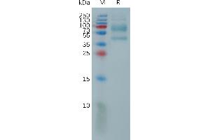 Human IL9 Protein, hFc Tag on SDS-PAGE under reducing condition.
